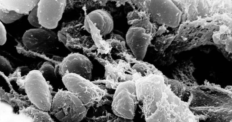 Bubonic Plague Case Confirmed in Arizona: Understanding the Risk and What It Means
